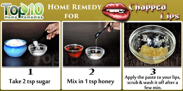 Lips chapped remedies winter these try